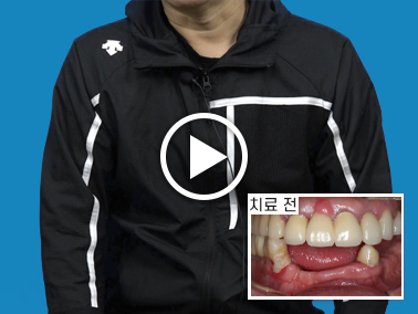 치료사례