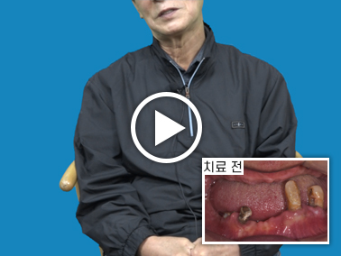 치료사례