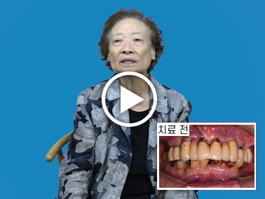 치료사례