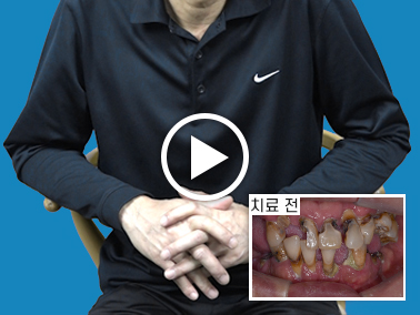 치료사례