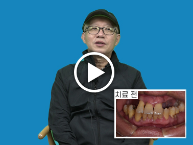치료사례