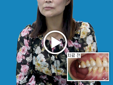 치료사례