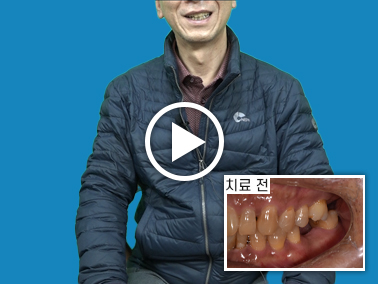 치료사례