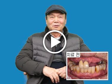 치료사례