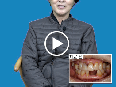 치료사례