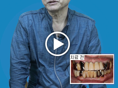 치료사례