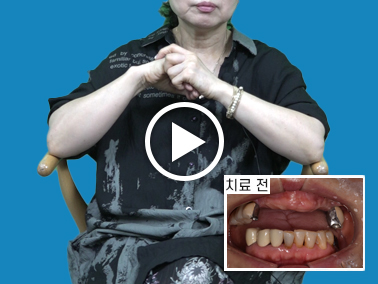 치료사례