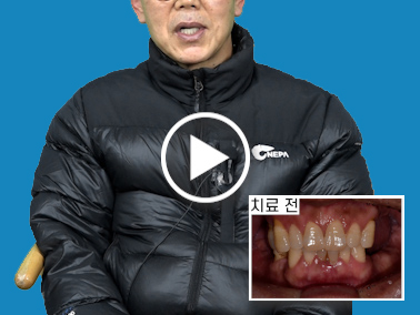 치료사례